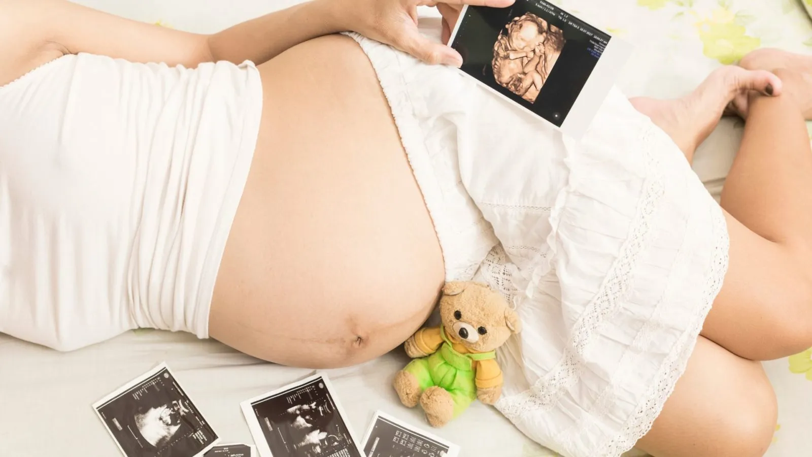 Benefits of 3D and 4D Ultrasound During Pregnancy